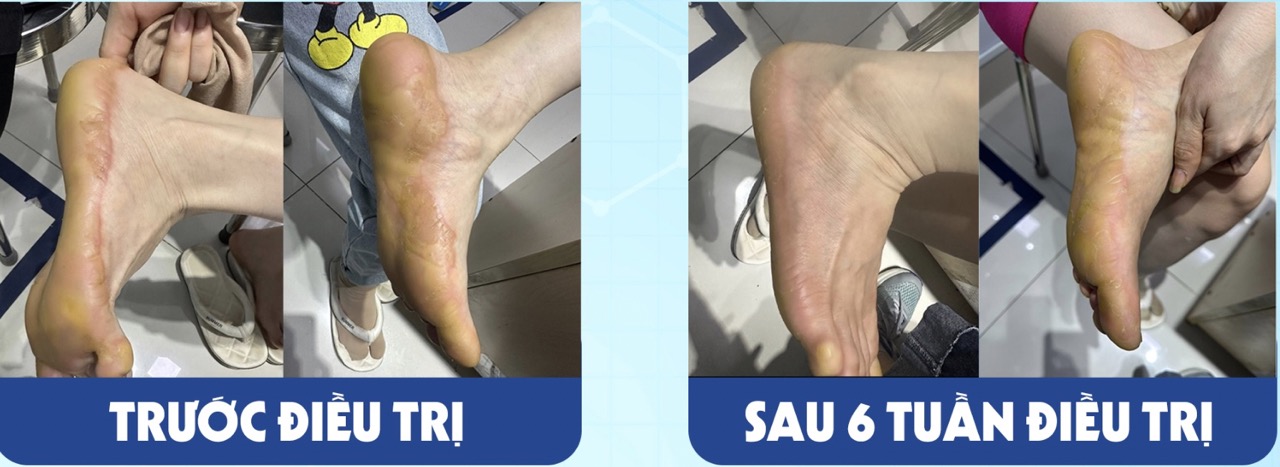 Bệnh nhân được bác sĩ điều trị thành công. Ảnh: THANH HÀ