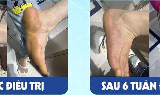 Bệnh nhân được bác sĩ điều trị thành công. Ảnh: THANH HÀ