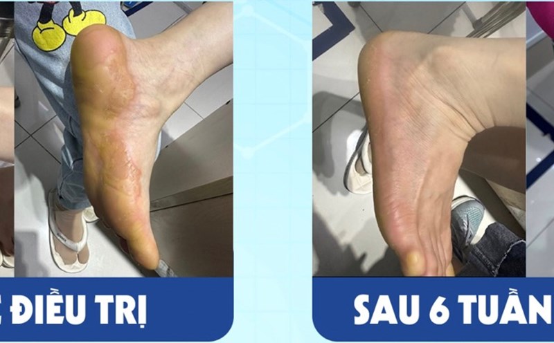 Bệnh nhân được bác sĩ điều trị thành công. Ảnh: THANH HÀ