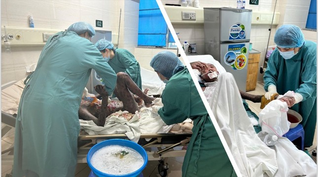 Nhân viên y tế thay băng, chăm sóc da cho bệnh nhân. Ảnh: BVCC