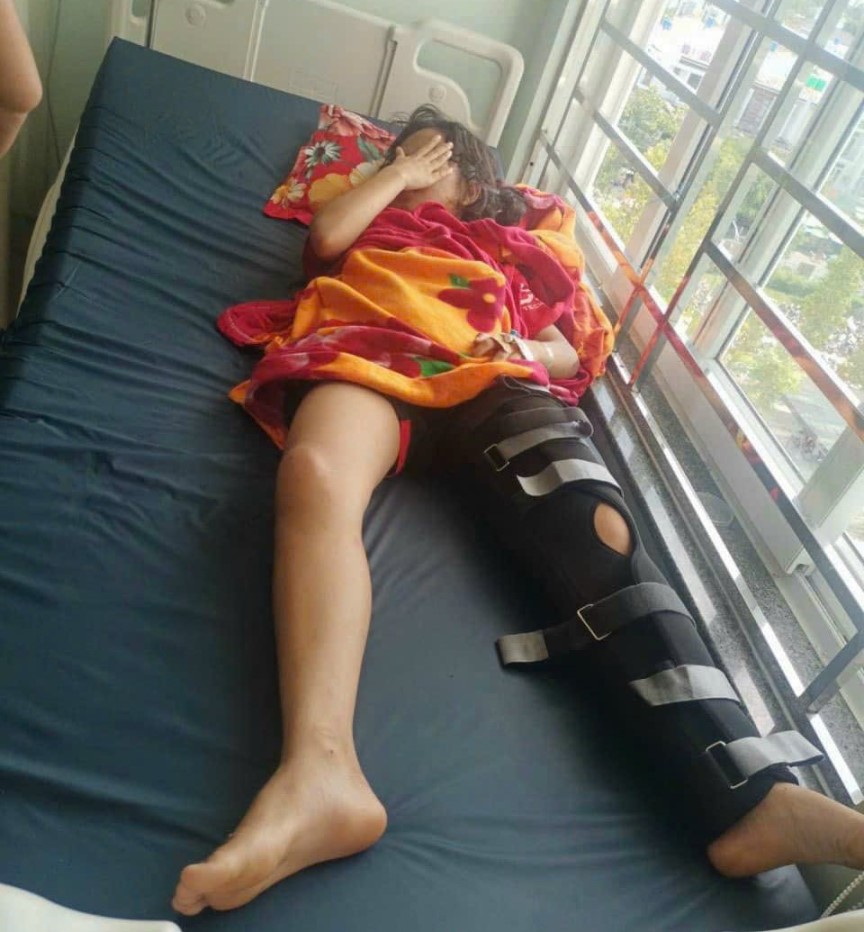 Sắp tới Tiên sẽ phải nằm một chỗ để ổn định lại xương chân. Ảnh: NVCC