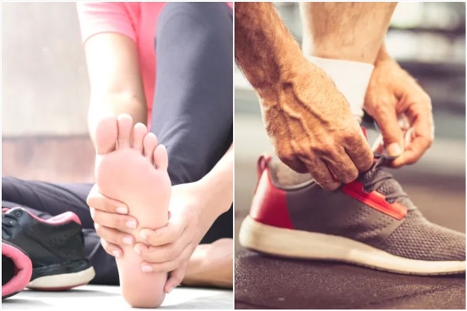 Viêm cân gan bàn chân là tình trạng khiến người bệnh cảm thấy đau nhói khó chịu và dai dẳng. Đồ họa: Thanh Thanh
