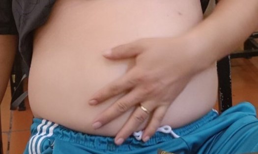 Béo phì, rượu bia là nguyên nhân phổ biến gây chậm thai, vô sinh.