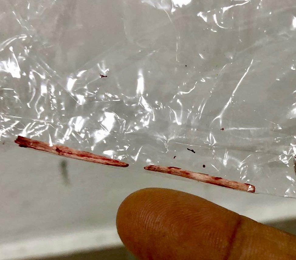 Mảnh xương cá lấy ra. Ảnh: BVCC