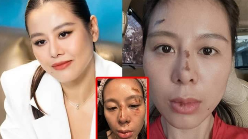 Sự thật về bức hình Nam Thư với gương mặt tiều tụy. Ảnh: Chụp màn hình.