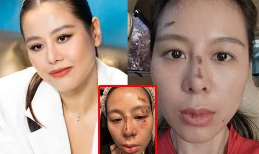 Sự thật về bức hình Nam Thư với gương mặt tiều tụy. Ảnh: Chụp màn hình.