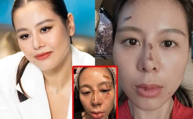 Sự thật về bức hình Nam Thư với gương mặt tiều tụy. Ảnh: Chụp màn hình.