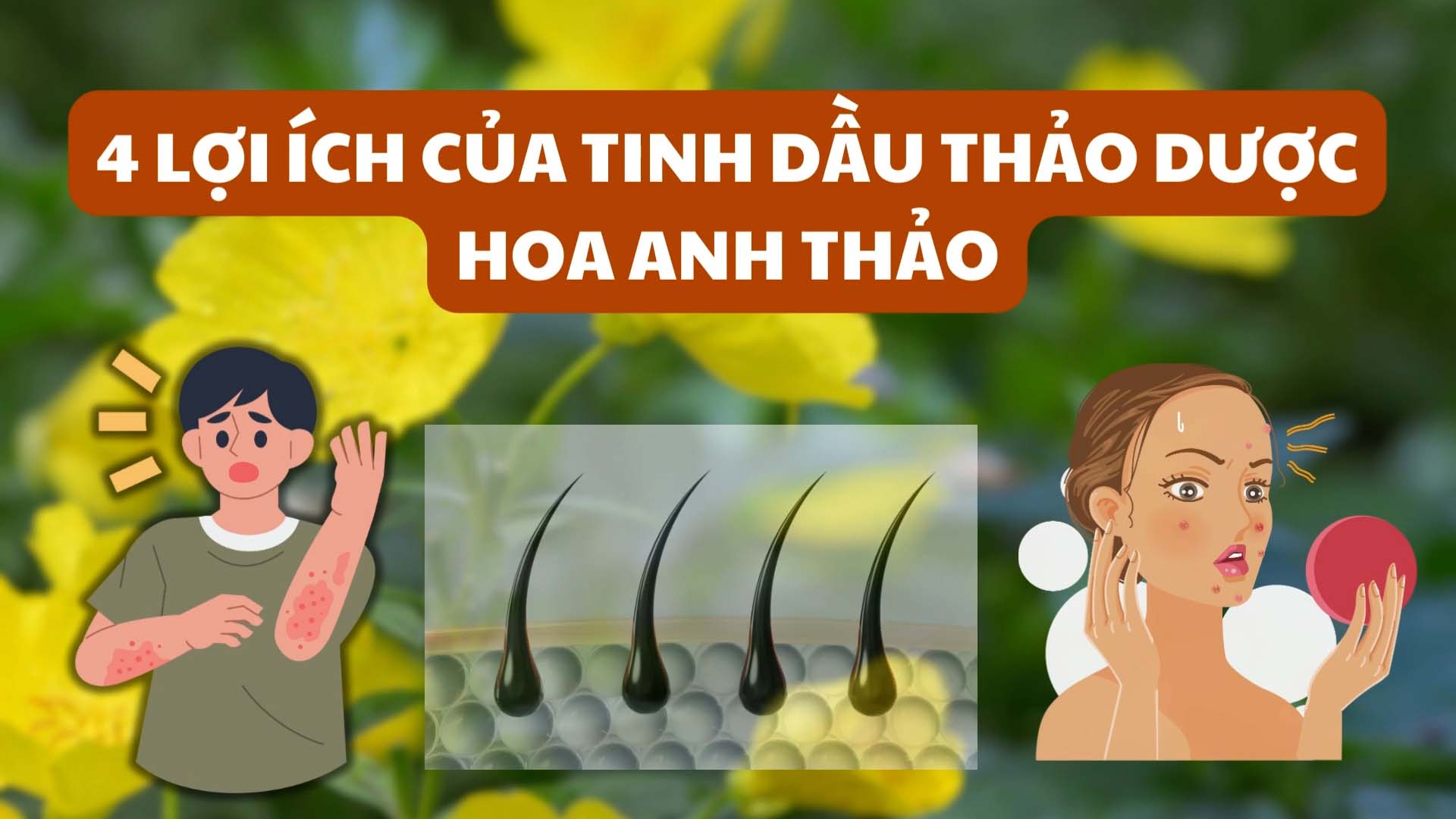 5 lợi ích của tinh dầu thảo dược hoa anh thảo