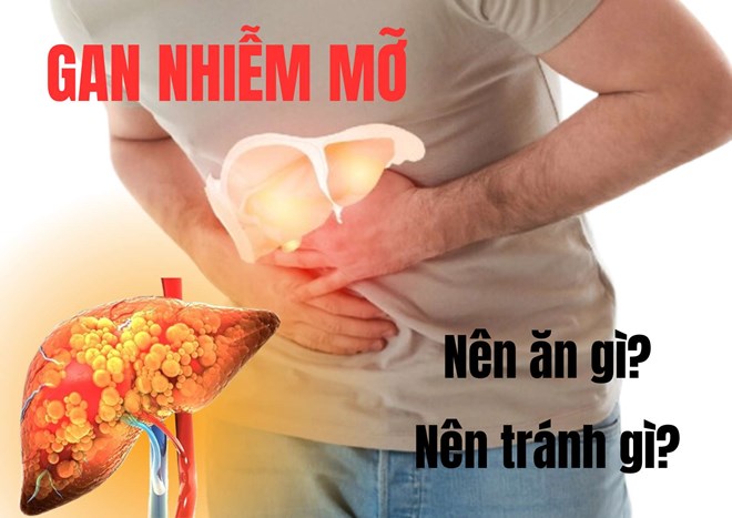 Người bị gan nhiễm mỡ nên và không nên ăn gì?