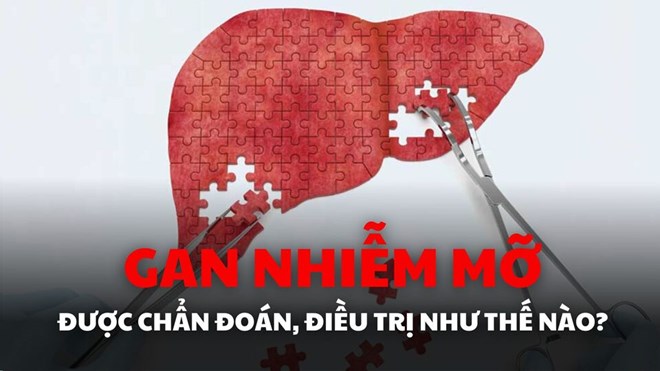 Được chẩn đoán gan nhiễm mỡ, điều trị như thế nào?