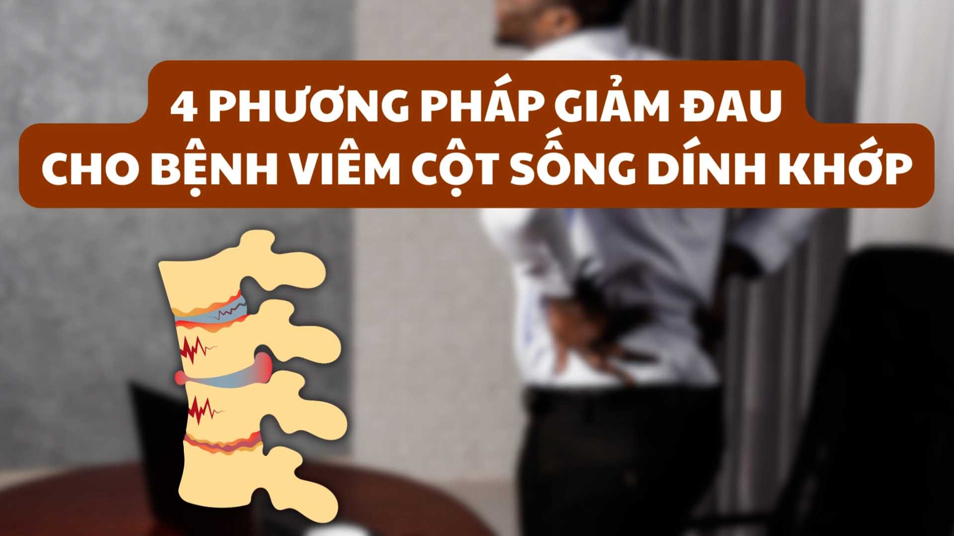 4 phương pháp giảm đau cho bệnh viêm cột sống dính khớp