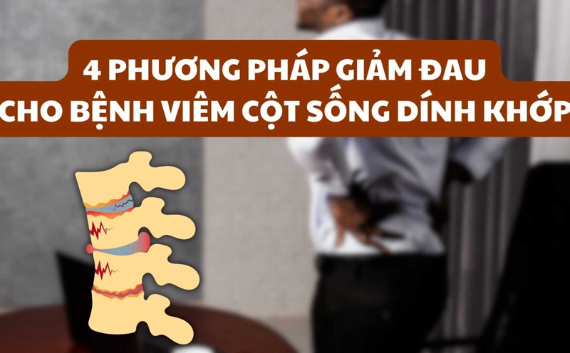 4 phương pháp giảm đau cho bệnh viêm cột sống dính khớp