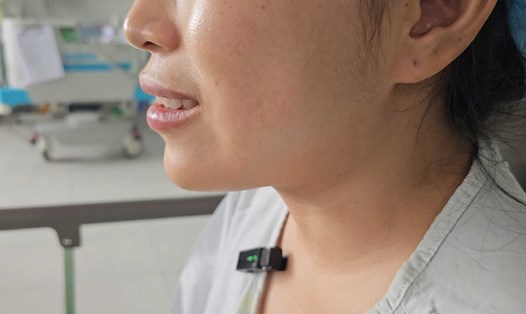 Vùng má của bệnh nhân trở về bình thường sau khi thực hiện thủ thuật. Ảnh: Bệnh viện cung cấp