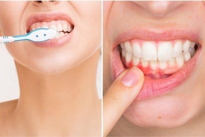 Bạn nên giữ bàn chải đánh răng ở góc 45 độ so với nướu để bảo vệ sức khỏe răng miệng. Đồ họa: An An