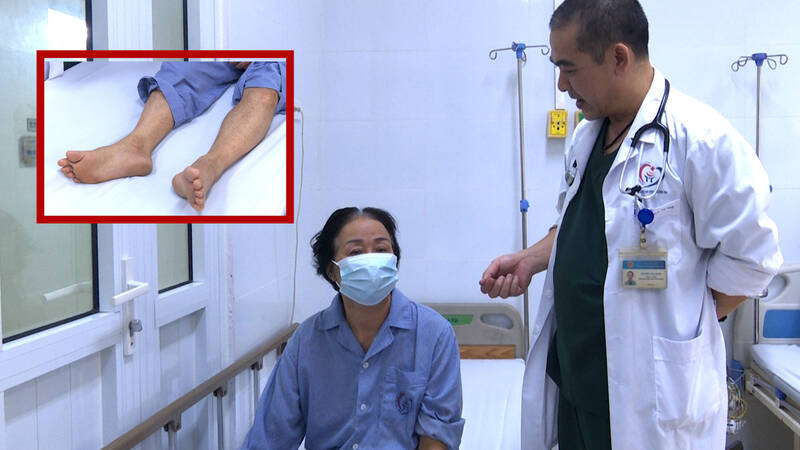 Tự điều trị sốt xuất huyết tại nhà, bệnh nhân có nguy cơ rối loạn đông máu