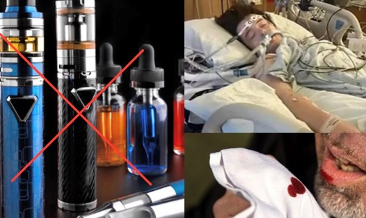 Đề xuất biện pháp cấm mọi hành động liên quan đến sản xuất thuốc lá mới. Đồ hoạ: Hương Giang