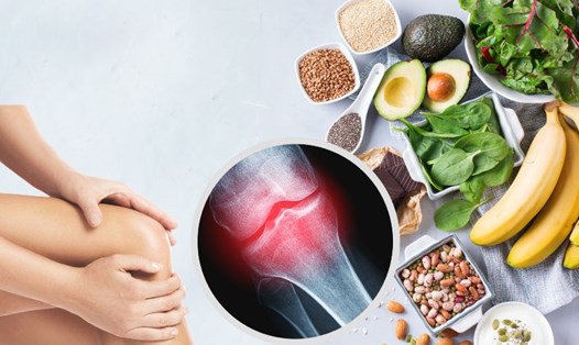 Chất dinh dưỡng tốt cho xương khớp ngoài canxi. Đồ họa: Hạ Mây