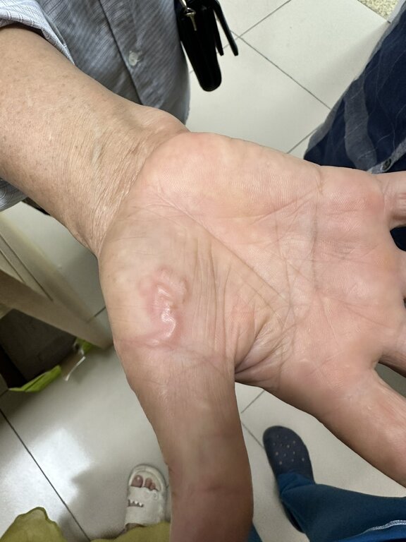 Hình ảnh giun đũa trong cơ thể. Ảnh: BVCC