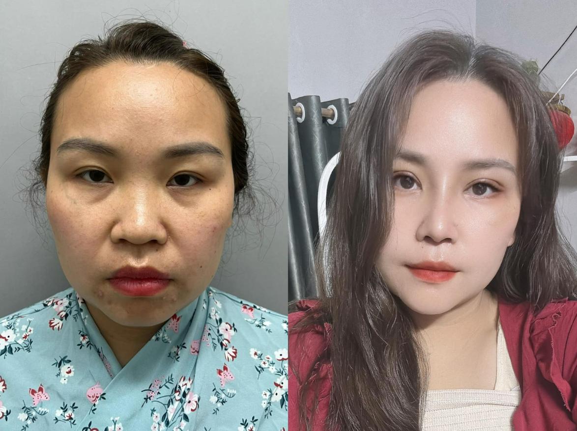 Ngoại hình của Phương Linh thay đổi rõ rệt. Ảnh: Nhân vật cung cấp