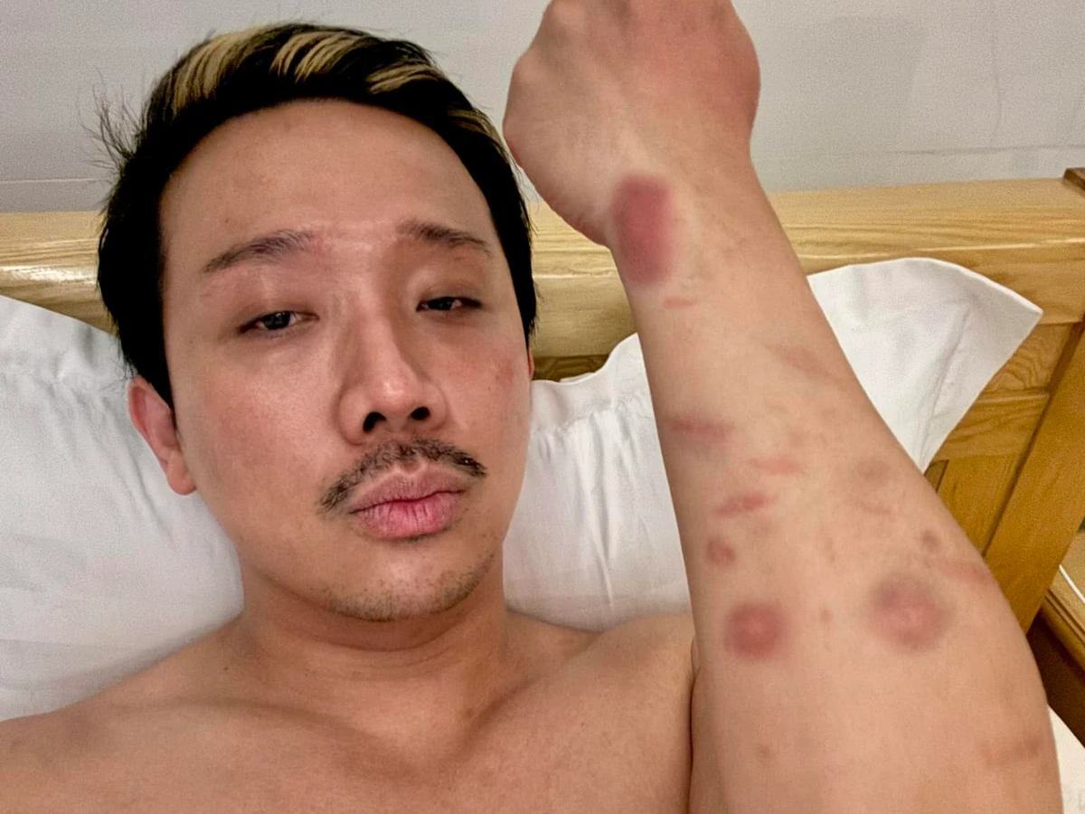 Tran Thanh was bruised because of the movie. Photo: Character Facebook.