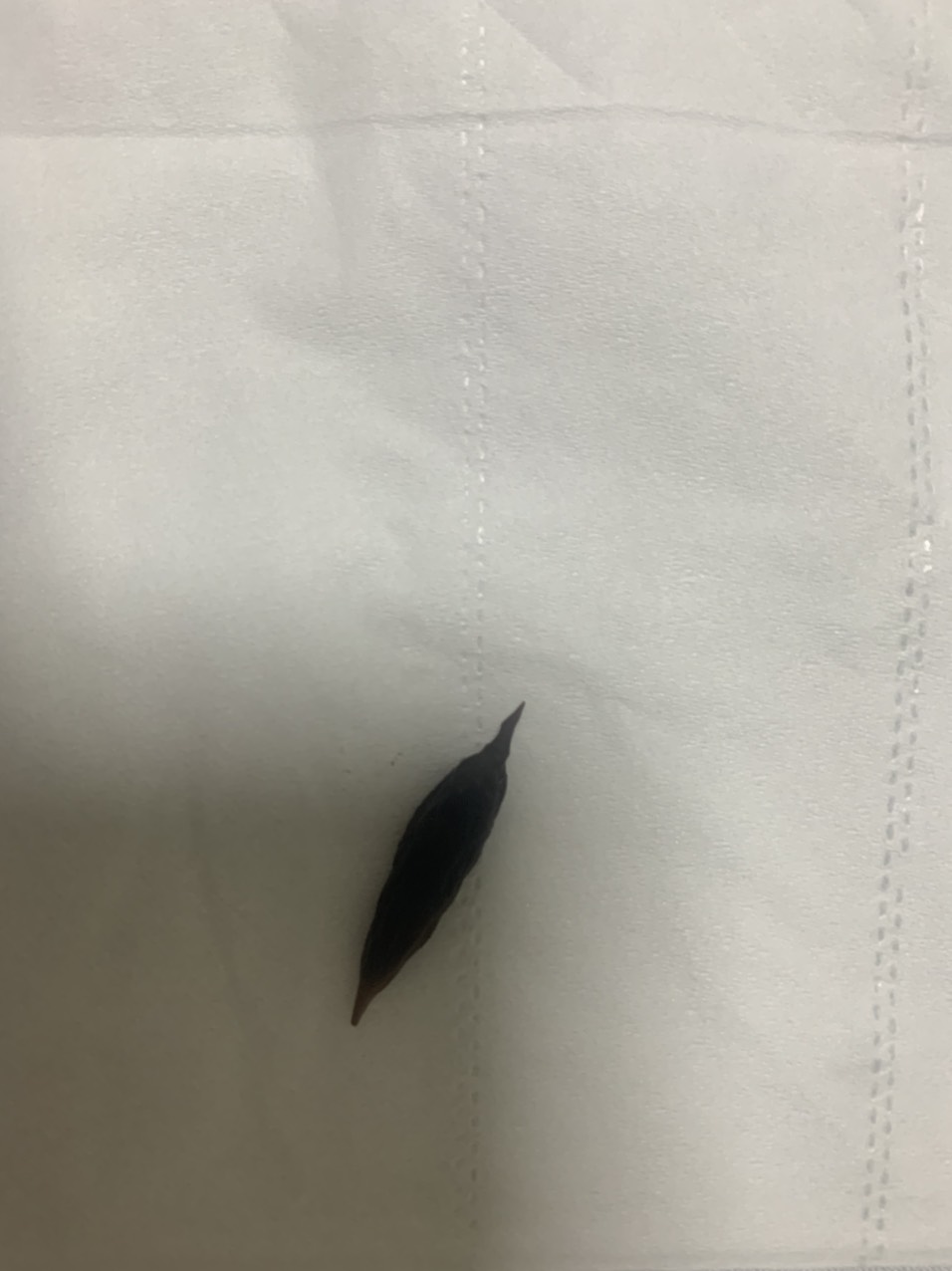 Dị vật được lấy ra khỏi cơ thể người bệnh. Ảnh: BVCC