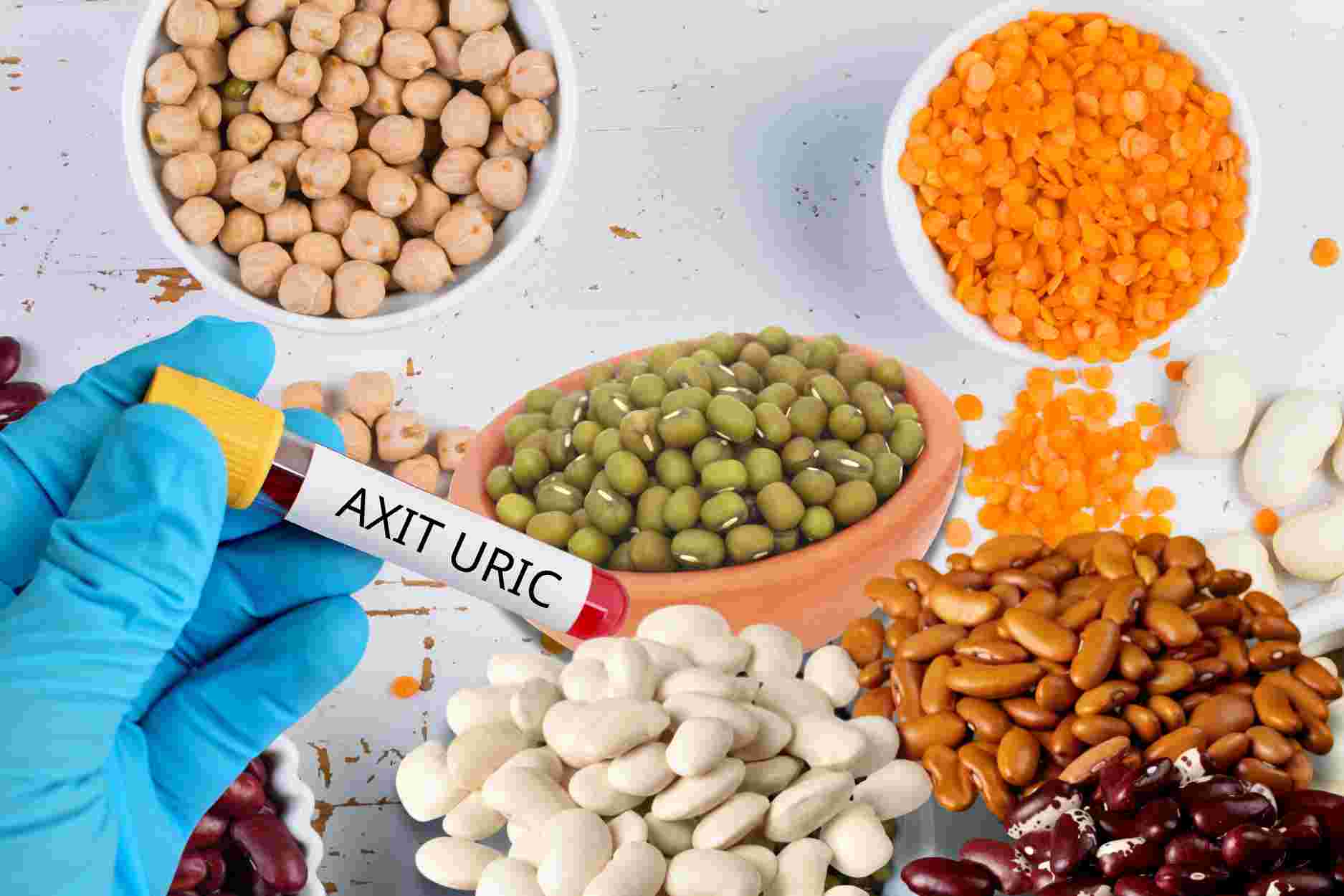 4 loại đậu nên tránh nếu có nồng độ axit uric cao