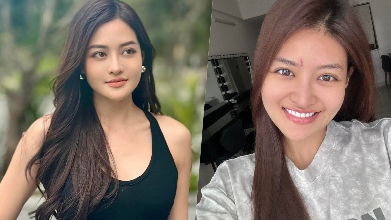 Hình ảnh của Thùy Anh trước và sau khi gặp chấn thương. Ảnh: Facebook nhân vật.