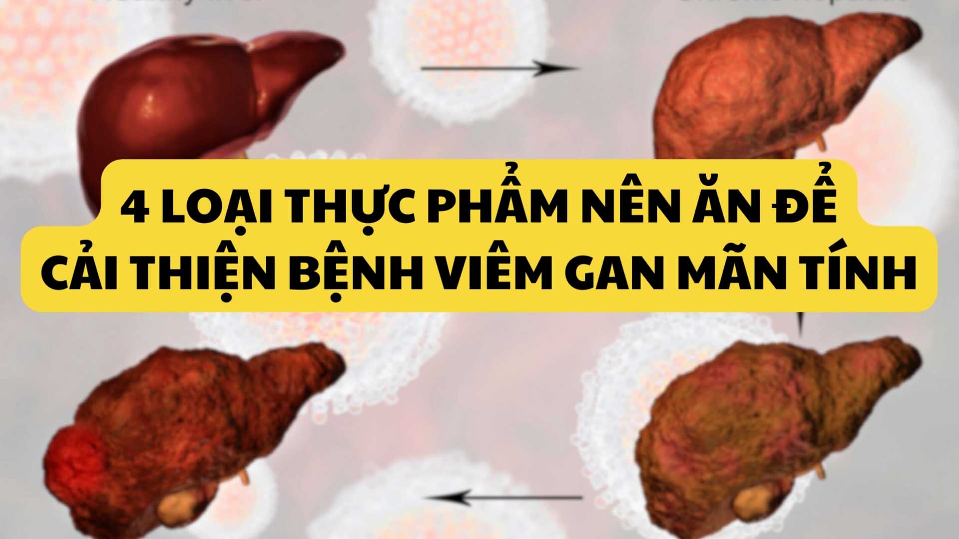 Loại thực phẩm nên ăn để cải thiện bệnh viêm gan mãn tính