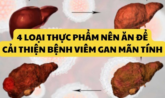 Loại thực phẩm nên ăn để cải thiện bệnh viêm gan mãn tính