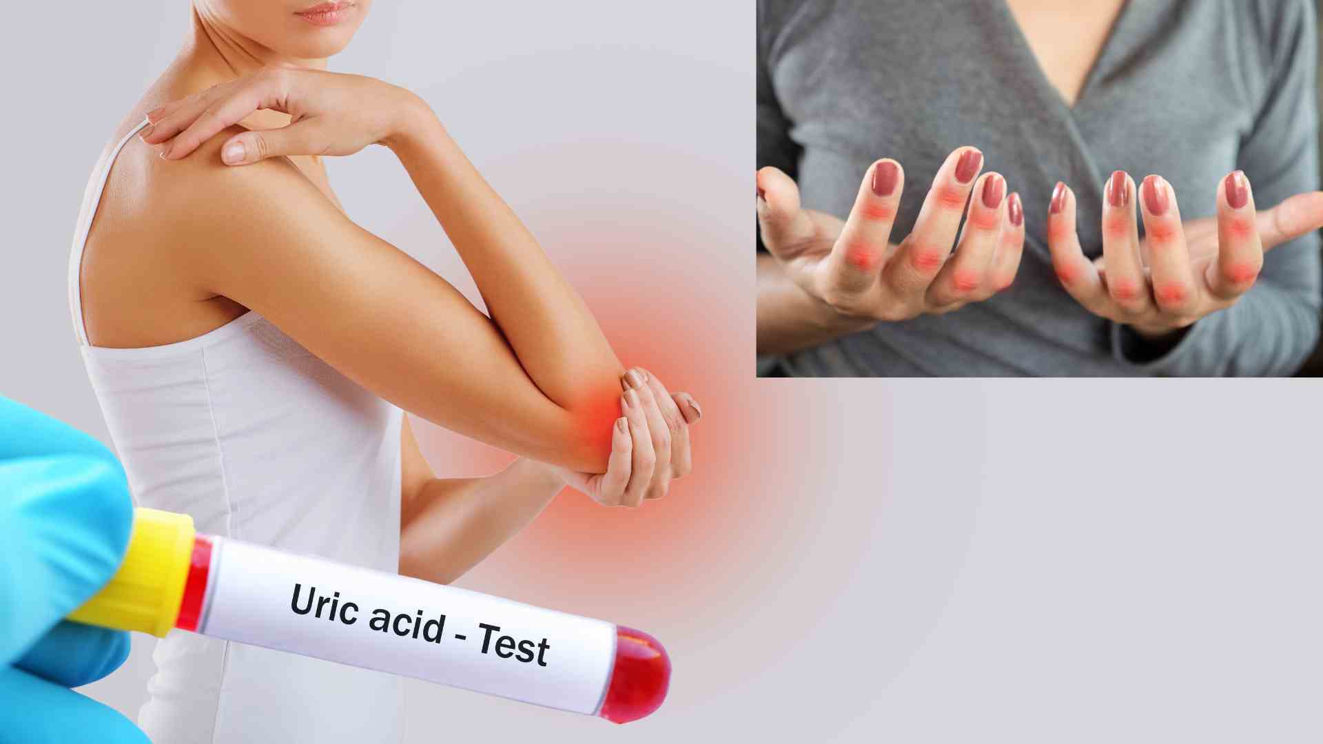 8 dấu hiệu cảnh báo axit uric tăng cao ở phụ nữ.