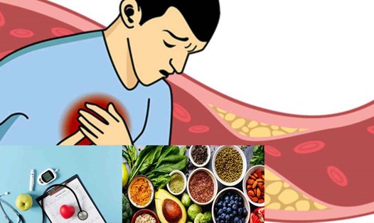 7 cách lựa chọn thực phẩm giảm cholesterol hiệu quả. Đồ họa: Cao Thơm