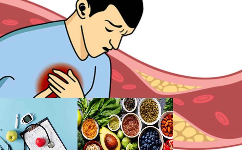 7 cách lựa chọn thực phẩm giảm cholesterol hiệu quả. Đồ họa: Cao Thơm