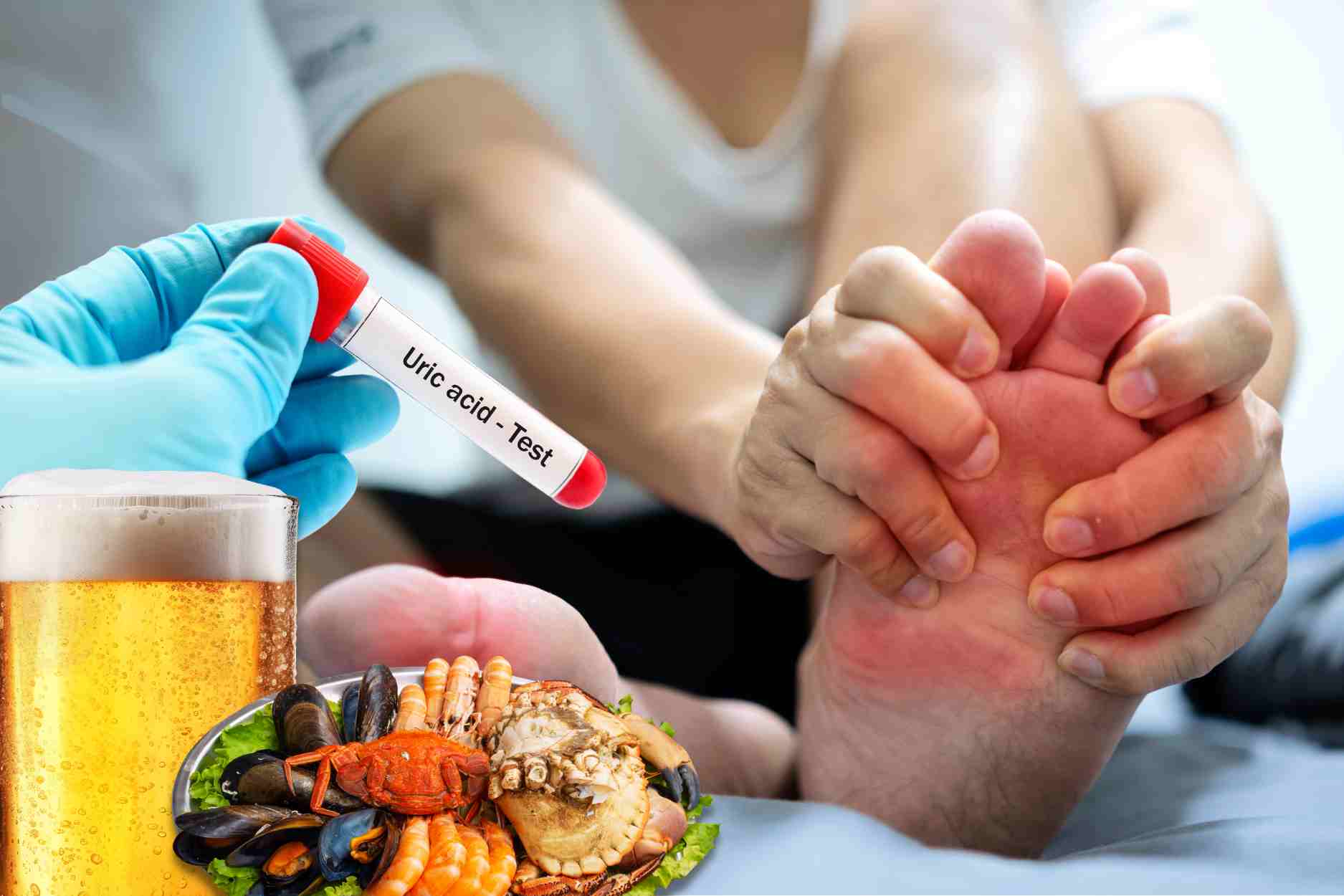 Nam giới dễ bị axit uric tăng cao.