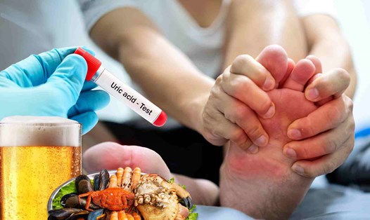Nam giới dễ bị axit uric tăng cao.