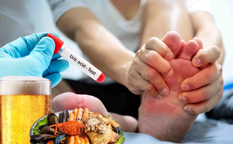 Nam giới dễ bị axit uric tăng cao.