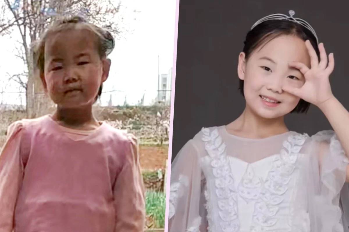 The girl changed amazingly after nearly 4 years of living with her stepmother. Photo: Douyin