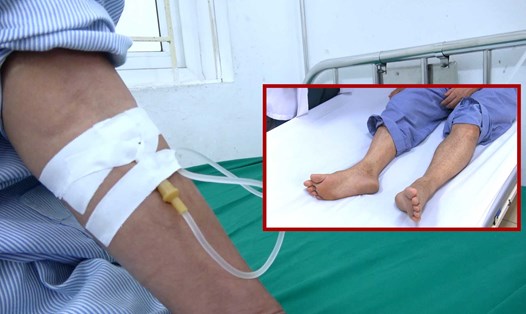 Dịch sốt xuất huyết bùng phát, số ca mắc tăng đột biến