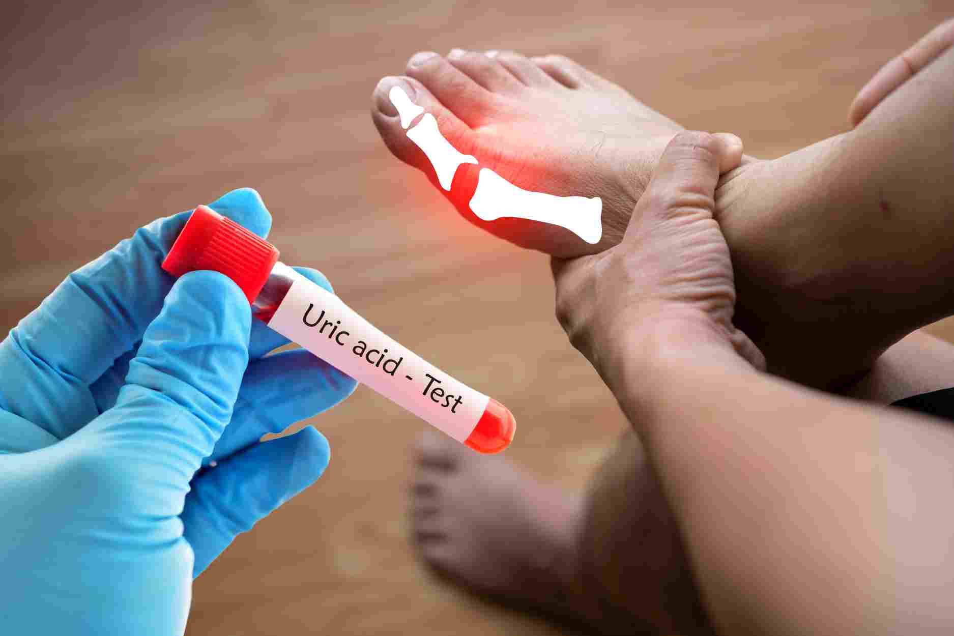 Axit uric cao là "kẻ thù" của những cơ quan nào trên cơ thể?