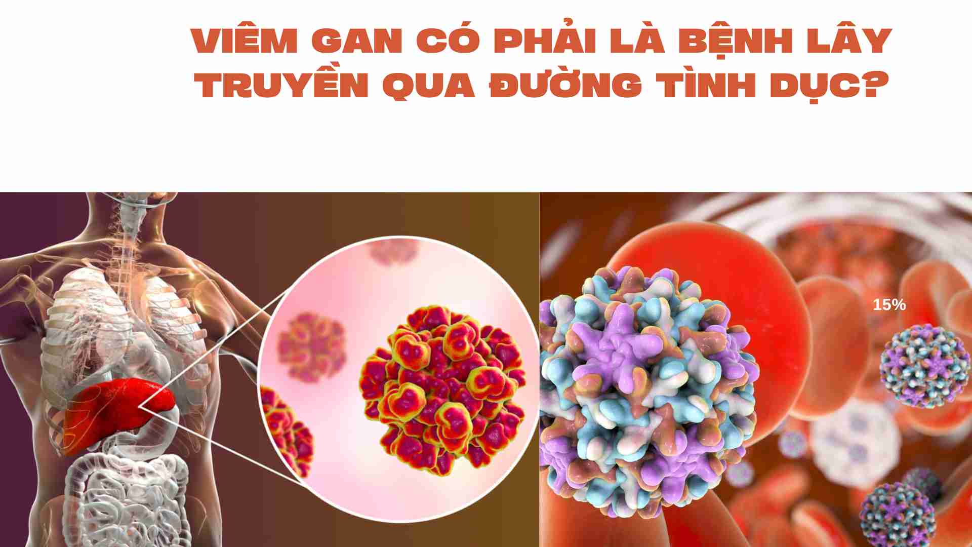 Viêm gan có phải là bệnh lây truyền qua đường tình dục? Đồ họa: Cao Thơm 