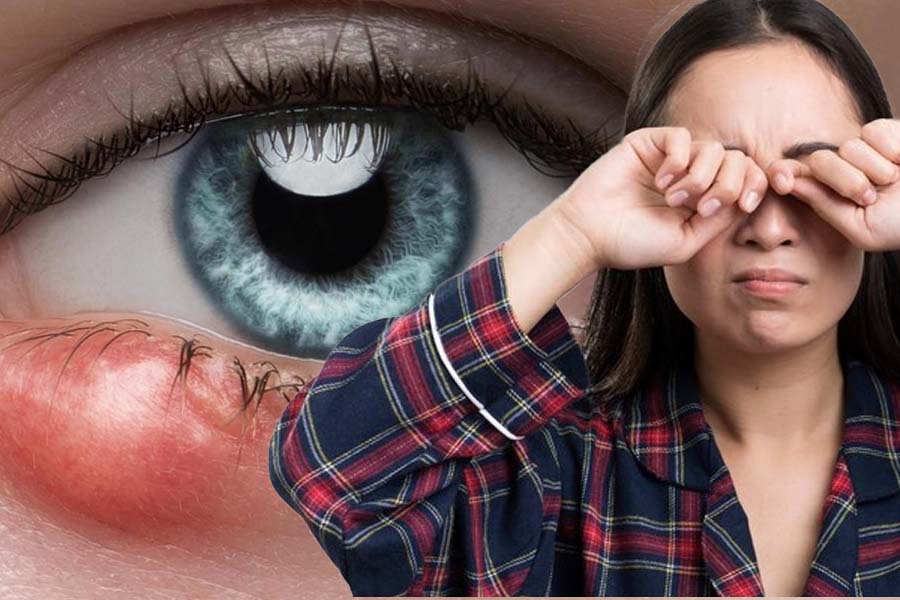 Cách bảo vệ bản thân khỏi lẹo mắt trong các đợt gió mùa. Đồ hoạ: Thiện Nhân