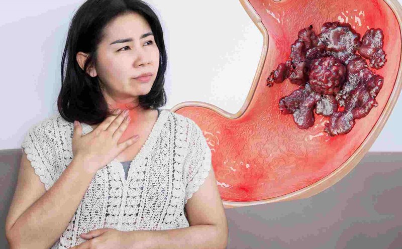 5 mẹo tránh trào ngược axit dạ dày hiểu quả trong giao mùa.