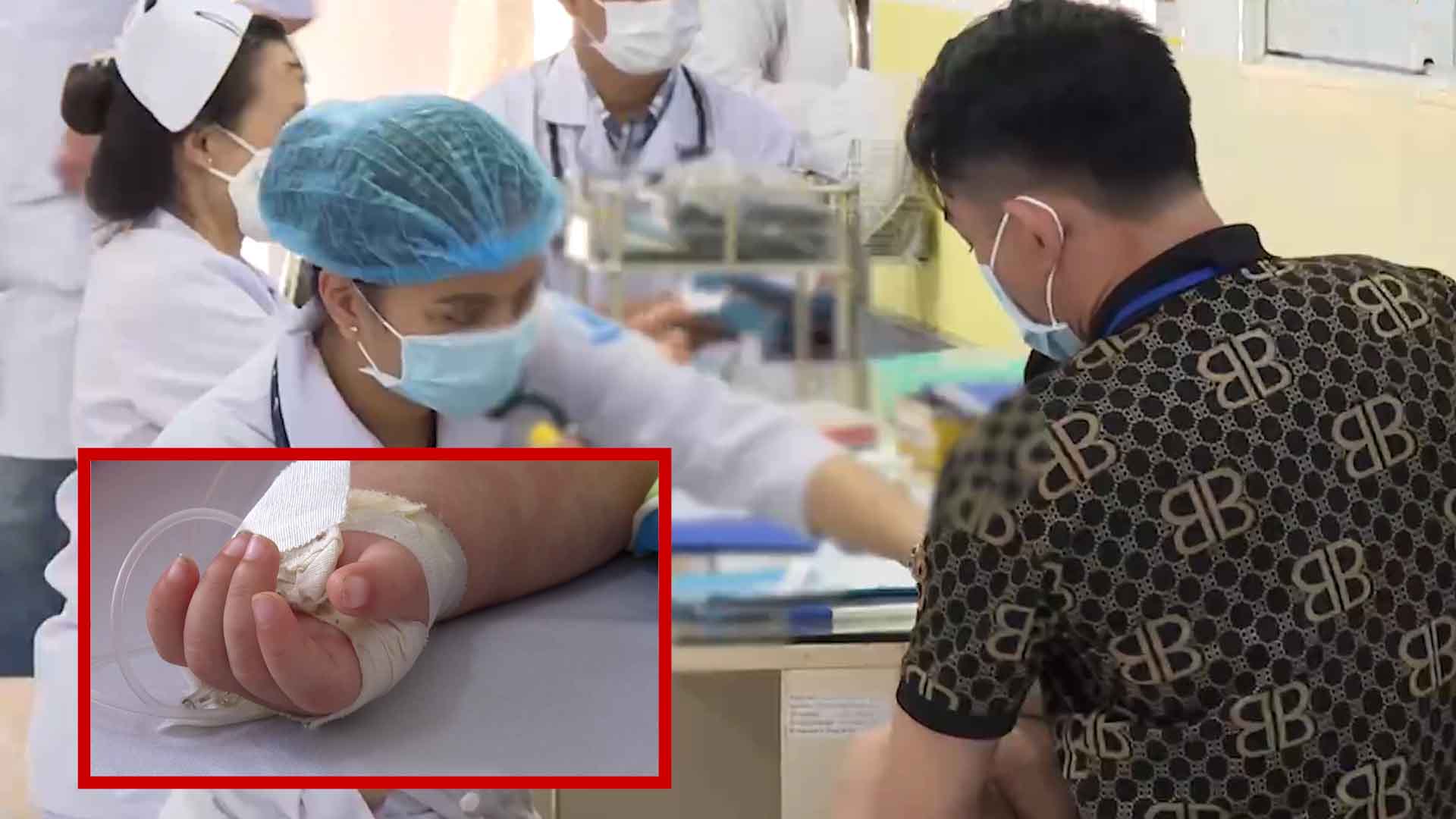 Bệnh sởi có tốc độ lây nhanh, mối lo ngại cho trẻ em
