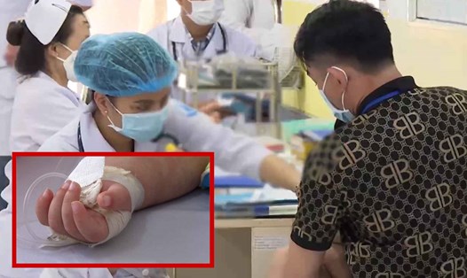 Bệnh sởi có tốc độ lây nhanh, mối lo ngại cho trẻ em