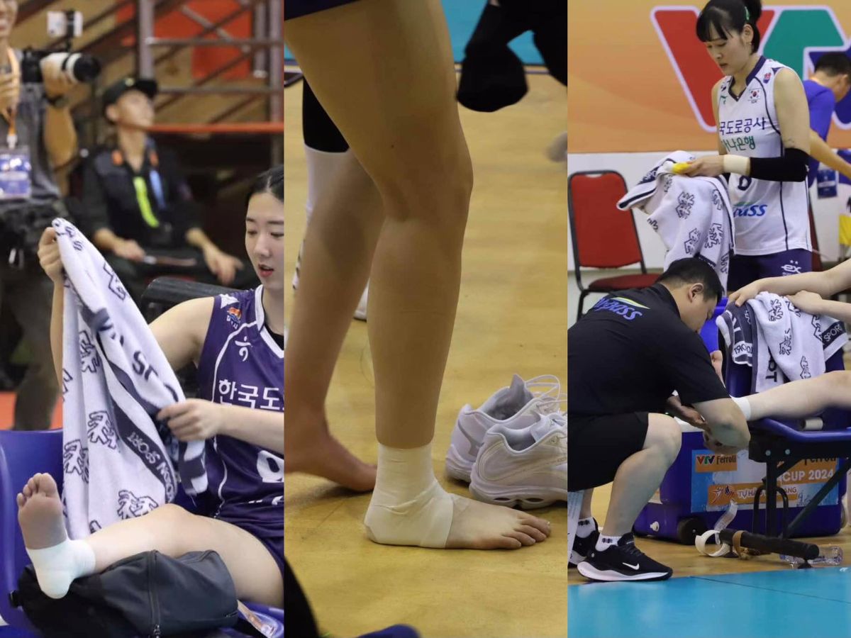 Kang So-hwi's ankle has a problem. Photo: Chi Tran