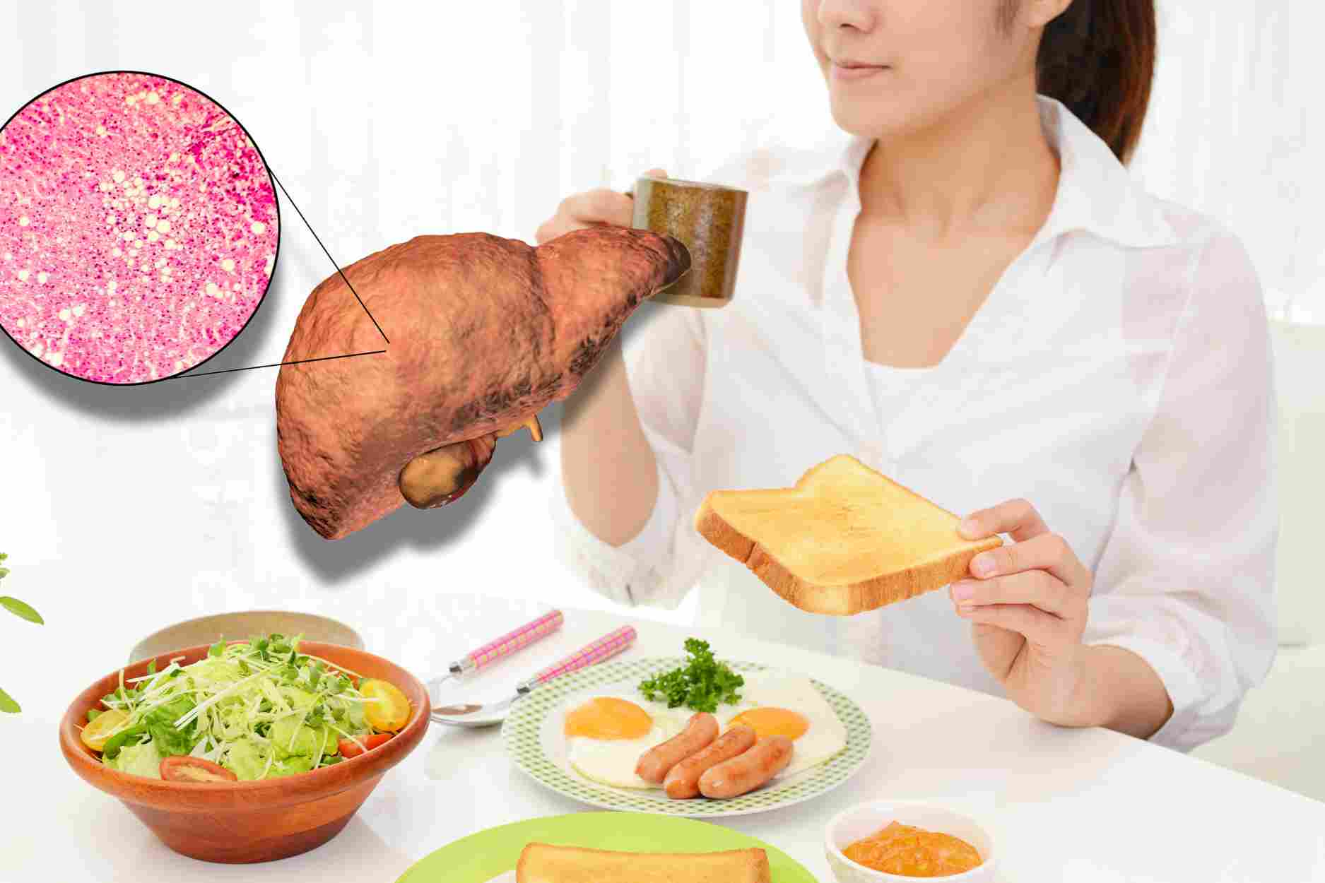 5 thói quen xấu ăn vào bữa sáng gây bệnh gan nhiễm mỡ