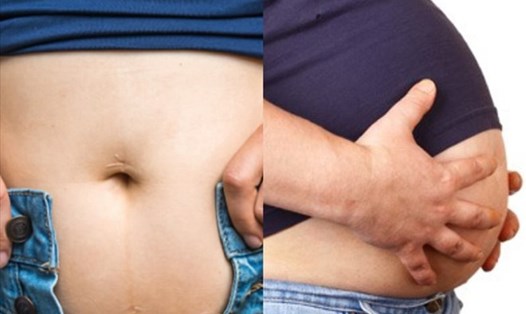 Tình trạng đầy hơi có thể xảy ra trong cả lúc thức và ngủ. Đồ họa: Thiện Nhân.