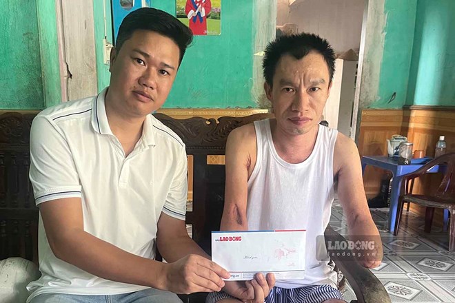 Trao hỗ trợ anh thợ hồ nghèo phải cắt cụt 2 tay