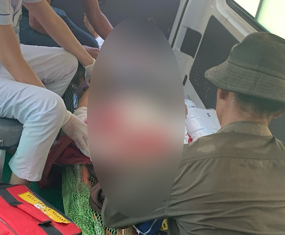 Chị N bị chấn thương sọ não khi bị đá đè trúng. Ảnh: H.Huyền