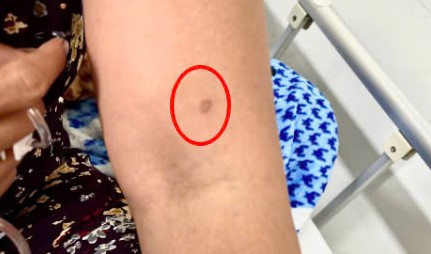 Ong vò vẽ là loài có nọc độc rất mạnh, có thể gây sốc phản vệ khi đốt. Ảnh: BVCC