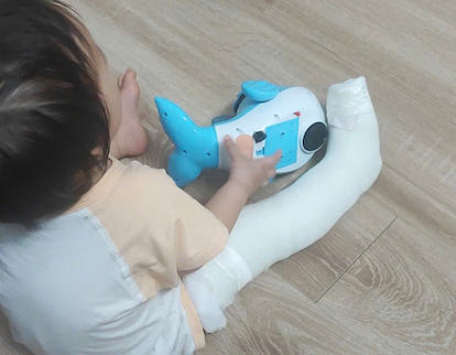 Phụ huynh cho biết, cháu bé 13 tháng bị gãy xương chân phải, phải bó bột, sau khi đón con ở trường hôm 13.8. Ảnh: Gia đình cung cấp

